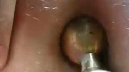 Села очком на фаркоп, потом на забор. Анальный фистинг, инсершн